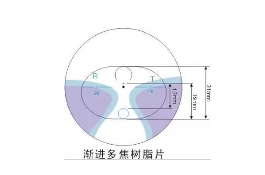 美麗島漸進(jìn)多焦鏡適合的人群，需要注意的事項(xiàng)