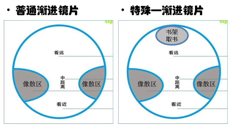 漸進多焦鏡的原理與應(yīng)用，3個光區(qū)，看遠近只需一副