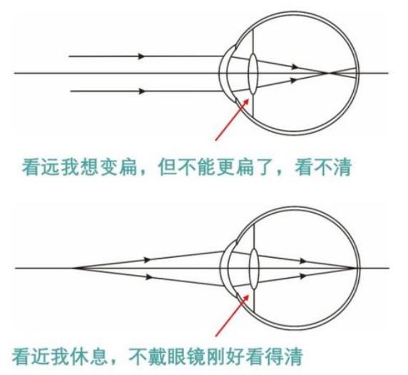 老花眼